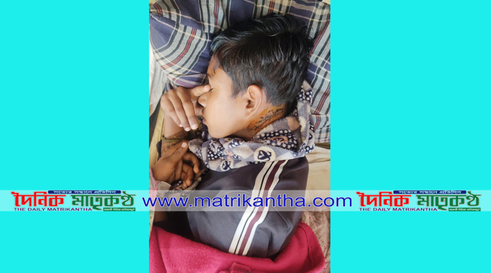  পাংশায় ফসলি জমি থেকে ঘাস কাটার অভিযোগে স্কুল ছাত্রকে কুপিয়ে জখম